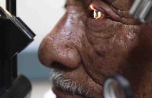 El Gobierno federal anuncia cirugías de cataratas gratis. ¿Cómo puedes acceder a una?